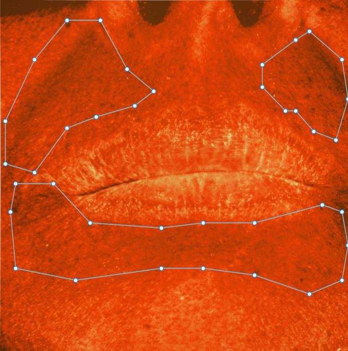 around mouth pigmentation after using TonEQ