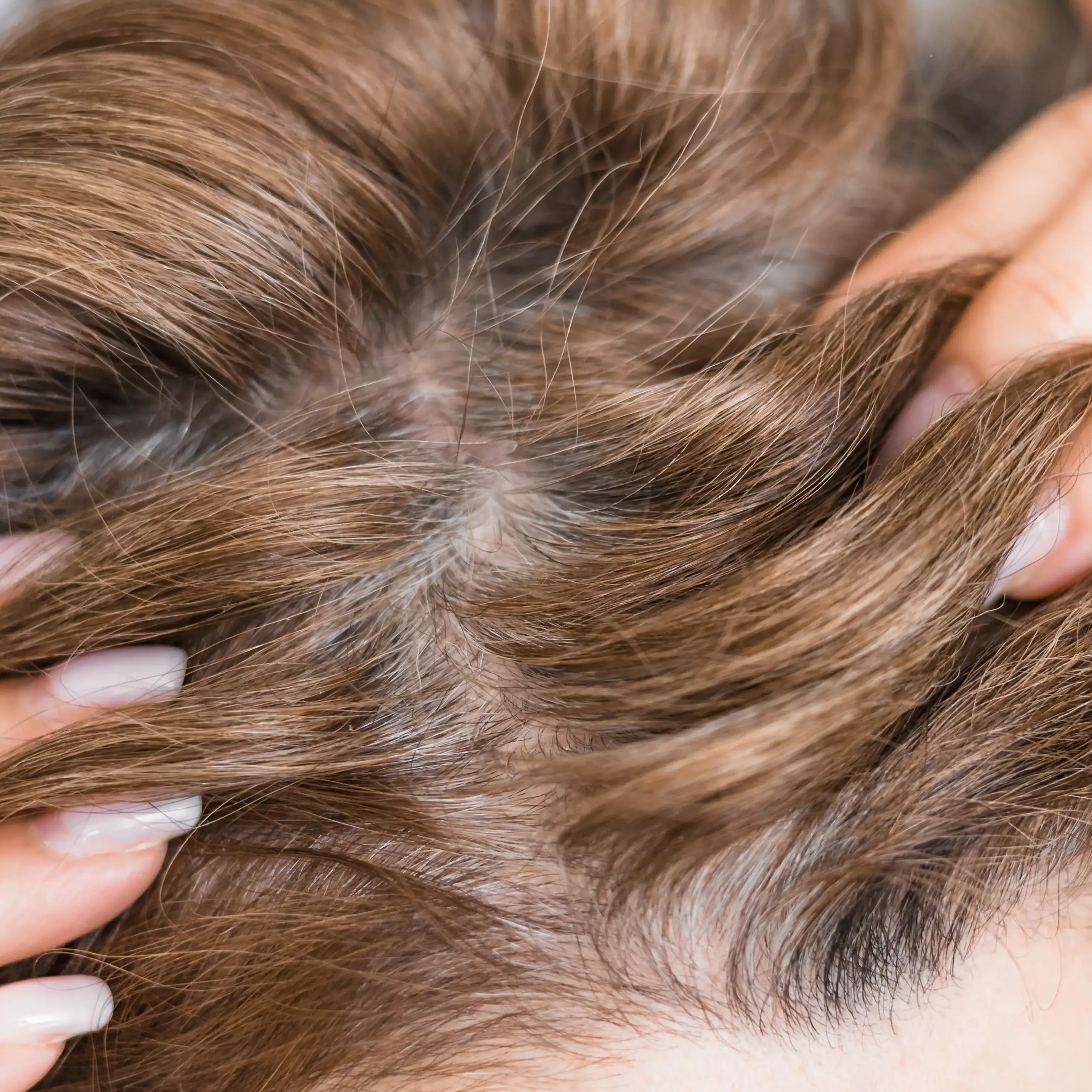 Hair and Scalp