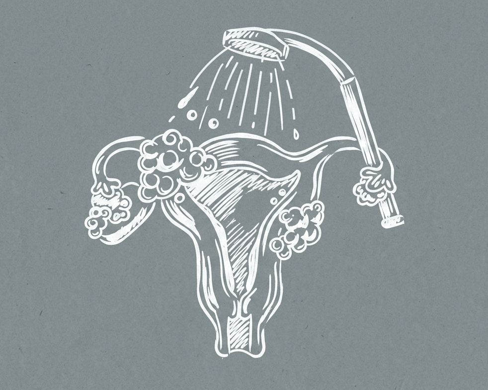 douche vaginale