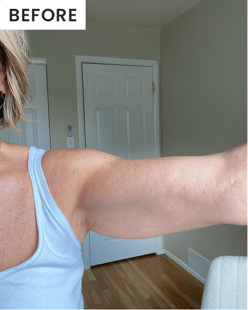 Before After GIF - Review 2