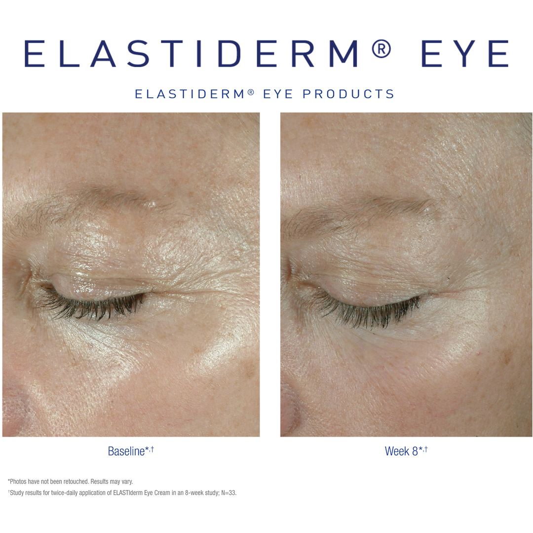 Obagi Elastiderm Eye Cream Reduces the Appearance of Eye Wrinkles.