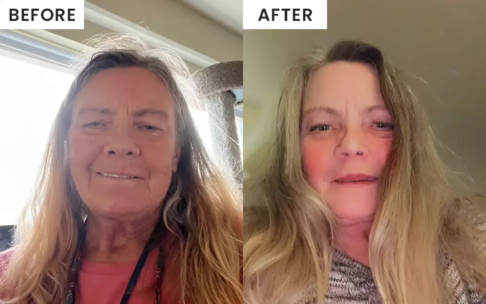 Before image of customer 1