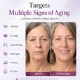 Strateva RX all in one anti aging serum targets wrinkles, dark spots, dark circles, fine lines, eye bags