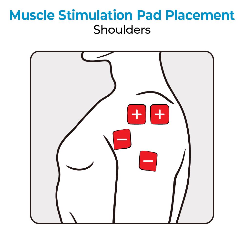 A diagram showing muscle stim pad placement for shoulders. Text, "Muscle Stimulation Pad Placement: Shoulders"