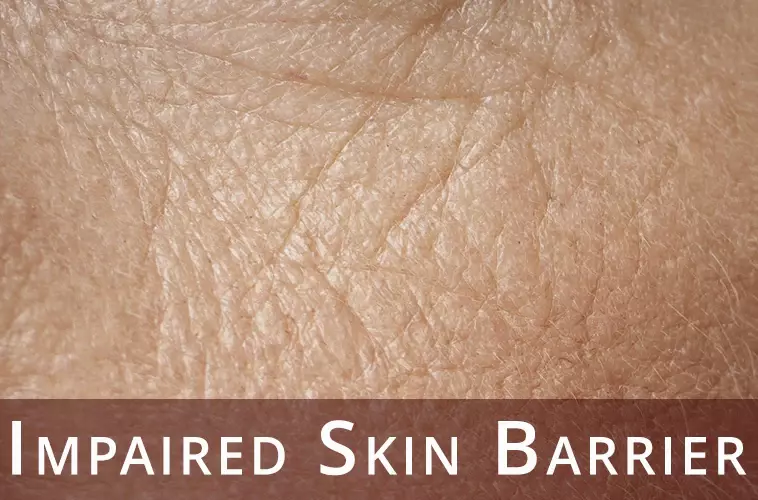 Impaired Skin Barrier - Desktop