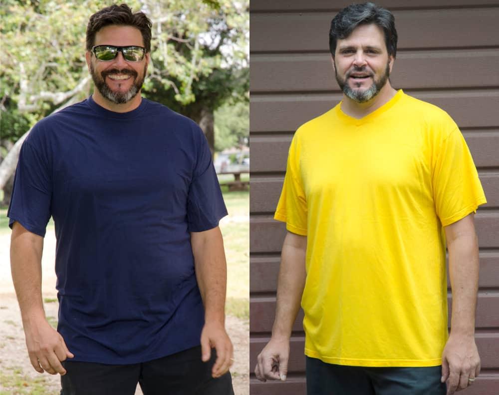 Buy Now Pay Later with Afterpay