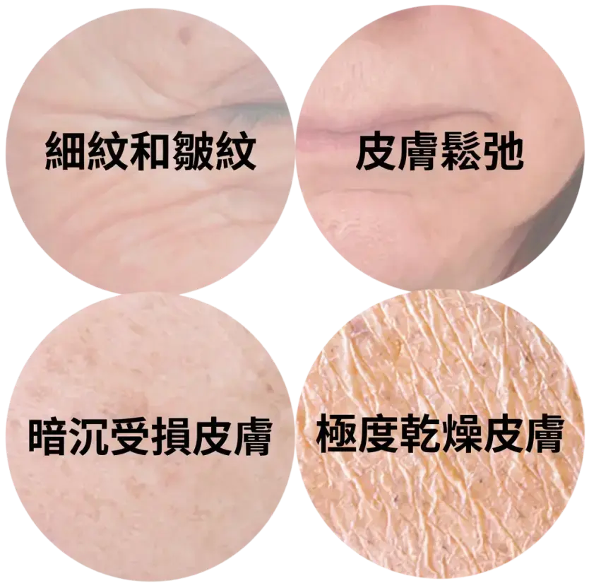 Fine lines & wrinkles, deflated skin, dull damaged skin and parched skin