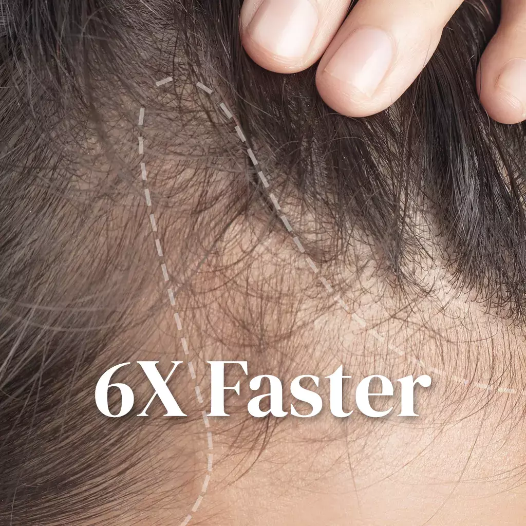 Scalp aging