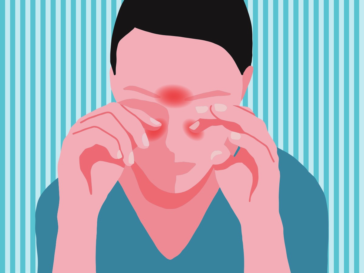 A girl rubbing her itchy eyes with red spots on her face indicates sinus pain.