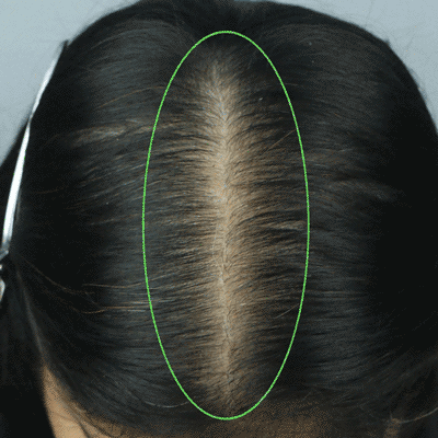 Week 12 – Hair top view