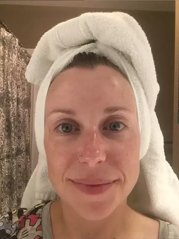 Before and after images of customer 5