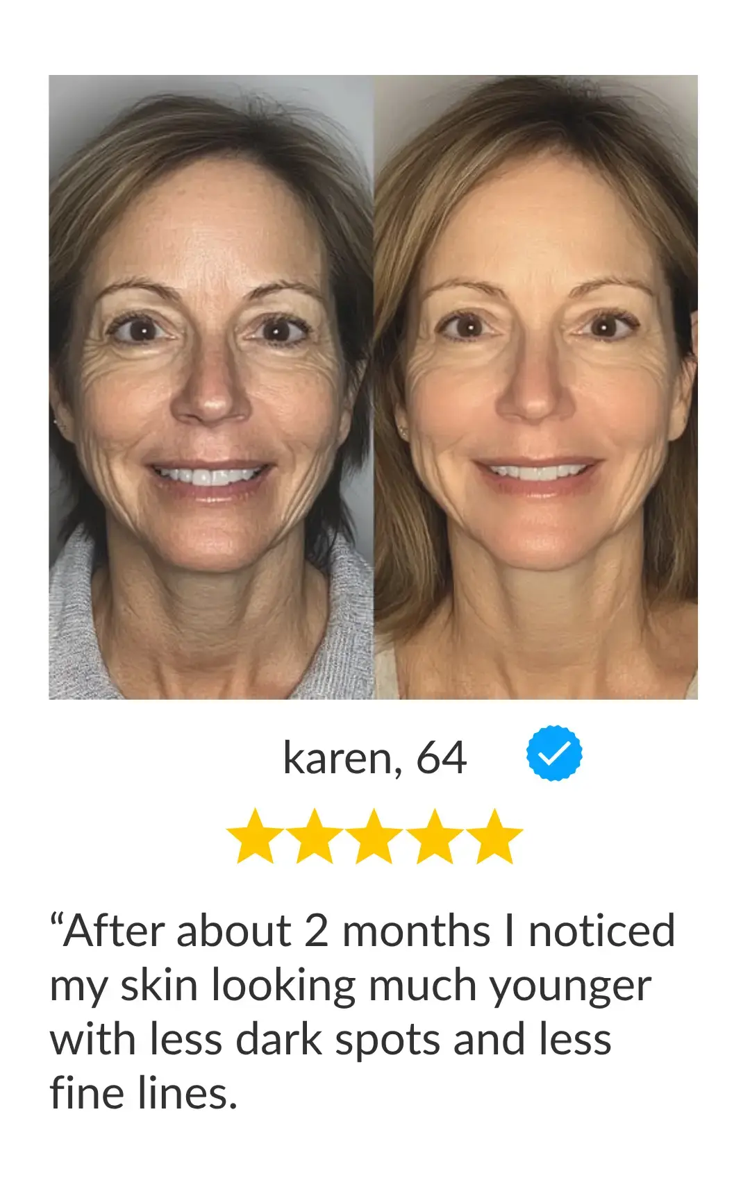 before after image showing long full lashes